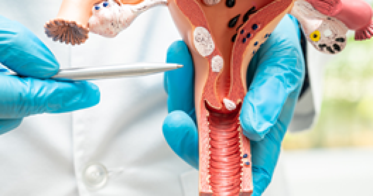 Does cervical cancer treatments automatically lead to infertility? » Professor Andreas Obermair