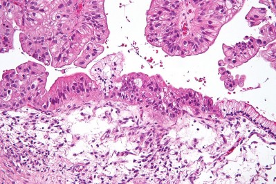 Pathology Slide