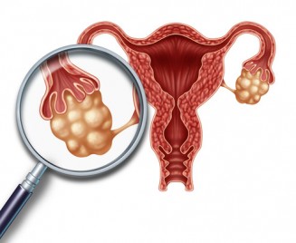 ovaries