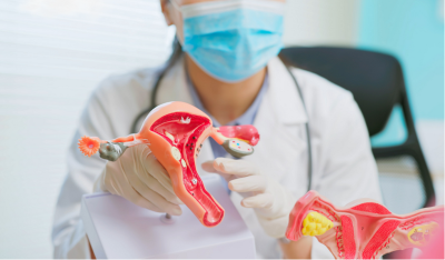 Doctor holding a model of a uterus