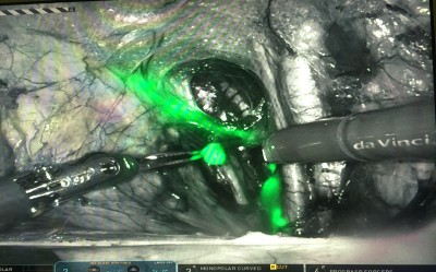 green dye3