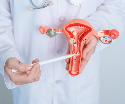 doctor holding a model of a diseased uterus